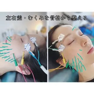 渋谷 小顔美容鍼 専門サロン YZのエステ・リラクイメージ