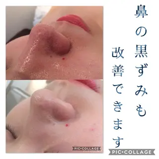 ミディアム カラー パーマ ヘアアレンジ メンズ キッズ ネイル マツエク・マツパ ニキビ・肌質改善専門 ♡人生が変わるサロンのエステ・リラクイメージ