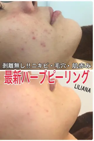 LILIANA ☆YURIのエステ・リラクイメージ