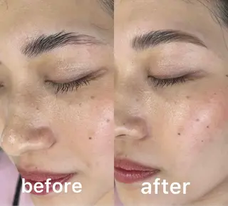 アイブロウ Akala miのエステ・リラクイメージ