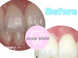 セルフホワイトニング エクシア浜松店のその他イメージ