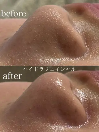 フェイシャルサロン CHIARA鈴木のエステ・リラクイメージ