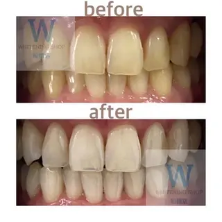 ホワイトニング ショップ船橋店🦷のエステ・リラクイメージ