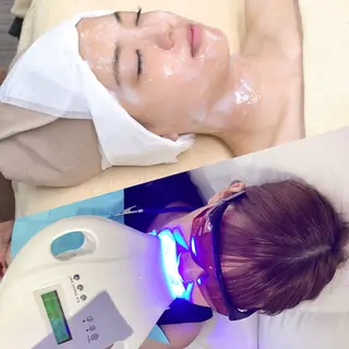 ホワイトニングテラス ティンクルのその他イメージ