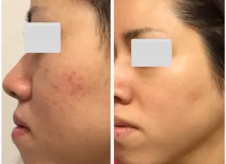 肌質改善サロン La Divinaのエステ・リラクイメージ