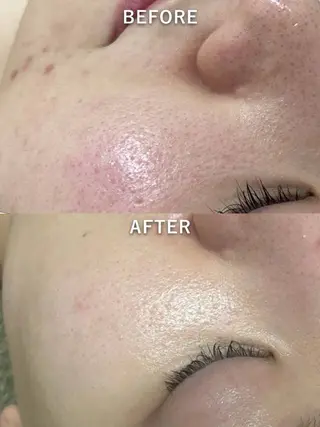 韓国美肌/肌質改善 【天神】のエステ・リラクイメージ