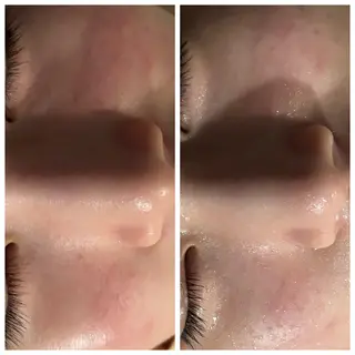 Mandarin Orange所属・毛穴から始める肌メン テマンダリンオレンジのエステ・リラクイメージ