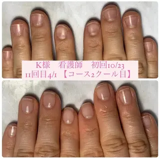 ネイル 自爪育成/深爪矯正 mikiのネイルデザイン