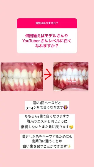 ホワイトニング/脱毛 専門店エクシア岡崎店のその他イメージ