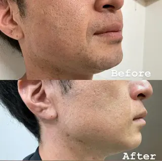 メンズ トータルビューティー サロンCherie2のエステ・リラクイメージ