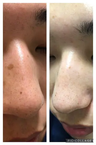 朝重い人専用 肩甲骨調整のエステ・リラクイメージ