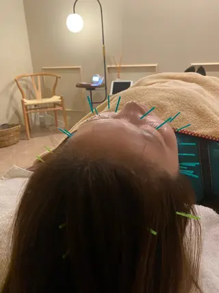 美容鍼/ヘッドスパ/ 💎さかもとのエステ・リラクイメージ