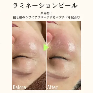 hue.所属・hue. YUKAのエステ・リラクイメージ