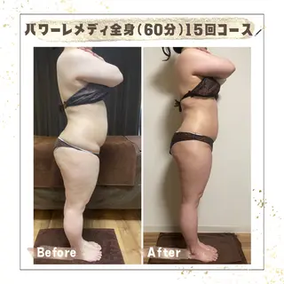 Luca 痩身× 疲労改善｜韓国肌管理のエステ・リラクイメージ