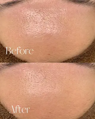 シミ🩷ニキビ専門店 Matteo🎀✨のエステ・リラクイメージ