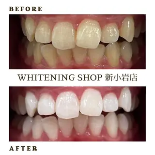 メンズ ホワイトニング ショップ新小岩店のその他イメージ