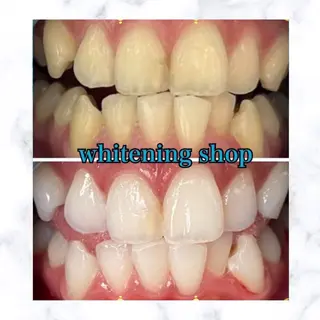 ホワイトニングショップ時津店所属・ホワイトニング ショップ長崎時津店のその他イメージ