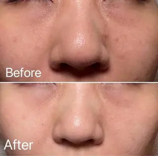 ナスサロasuka. 🕯️🤎のエステ・リラクイメージ