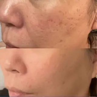 LOUISE. ／肌質・頭皮のエステ・リラクイメージ