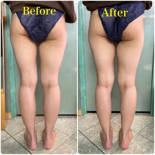 DeCoLé Beauty所属・艶肌/敏感肌/若さ/ ボディ痩身🌿のエステ・リラクイメージ