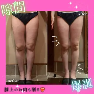 痩身&美肌サロン 堀米✨のその他イメージ