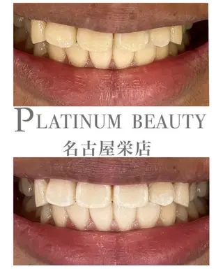プラチナムビューティ 名古屋栄のその他イメージ
