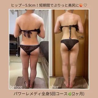 《本気痩せ×疲労改善 》  BILOOPのエステ・リラクイメージ