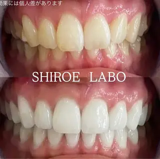 【歯のホワイトニング専門店】シロエラボ梅田店所属・シロエラボ 梅田店のその他イメージ