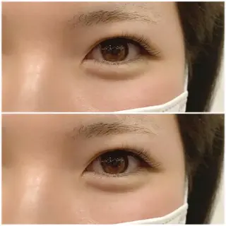 マツエク・マツパ mint eyelash山本のマツエク・マツパデザイン
