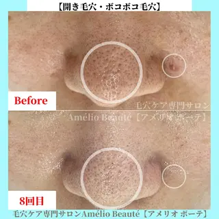 毛穴ケア専門サロン アメリオボーテのその他イメージ