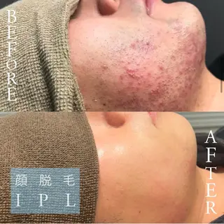 Lilyboo 池袋のエステ・リラクイメージ