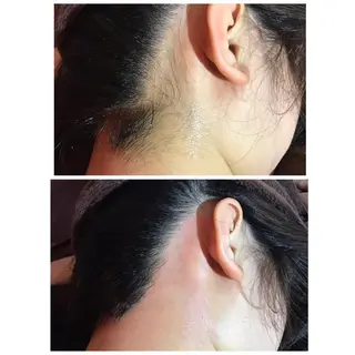 代表 MOMOのエステ・リラクイメージ