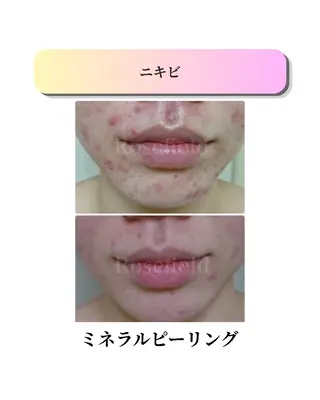 ローズフィールド 森岡朋美のエステ・リラクイメージ