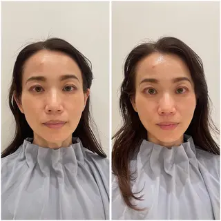 🌸美容鍼サロン🌸 メゾンブランシェ🌈のエステ・リラクイメージ