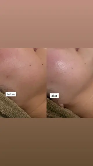 haneul ‹ハヌル›のエステ・リラクイメージ