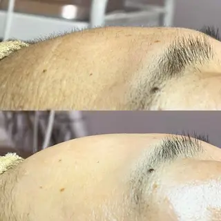 毛穴・頭皮 専門店💪のその他イメージ