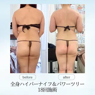 espresso,所属・《痩身、小顔専門店》 エスプレッソのエステ・リラクイメージ