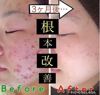 セミロング カラー パーマ ヘアアレンジ メンズ キッズ ネイル マツエク・マツパ ニキビ・肌質改善専門 ♡人生が変わるサロンのエステ・リラクイメージ