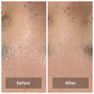 bonuru salonのエステ・リラクイメージ