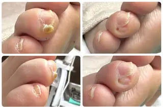 東京巻き爪 アカデミーのエステ・リラクイメージ