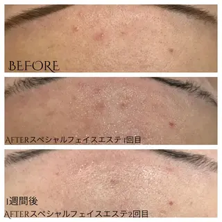 ビューティー ミロワールのエステ・リラクイメージ