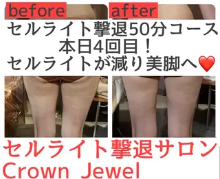 Crown  Jewel所属・CrownJewel クラウン ジュエルのエステ・リラクイメージ