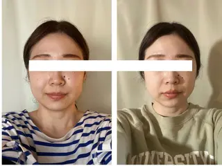 丸顔さんの救世主 高田 くみのエステ・リラクイメージ