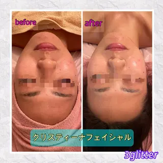 3glitter 肌質改善＆痩身のエステ・リラクイメージ