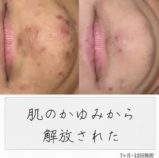 ニキビ経験者が施術 する専門サロン🌻のエステ・リラクイメージ