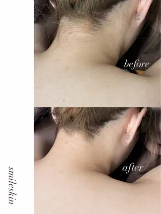 smileskin 京都/meguのその他イメージ