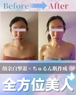 痩身ハーブピーリング 筋膜リリース☆B&Hのエステ・リラクイメージ