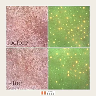 Bebe×DiDiA 金沢本店のエステ・リラクイメージ