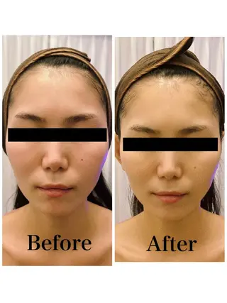 CHANCE （チャンス）のエステ・リラクイメージ