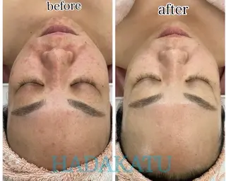 総合エステサロン 肌活のエステ・リラクイメージ